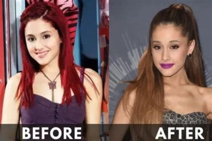 Ariana Grande Weight Loss: Her Before & After Photos, Who Is Ariana Grande? - SarkariResult
